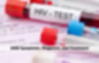 Seorang Pria dalam Video ‘Vina Garut’ Positif HIV, Ini Gejala Seorang Pria Terjangkit HIV, Salah Satunya Terlihat di Mulut dan Hidung