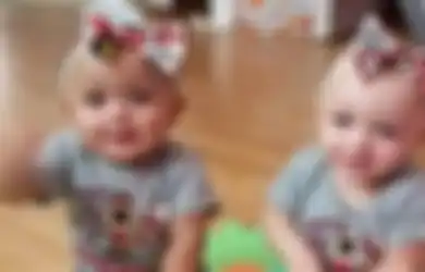‘Saya Tidak Melihat Ada Perbedaan Warna,’ Kata Ibu Bayi Kembar yang Lahir dengan Ras dan Warna Kulit yang Berbeda
