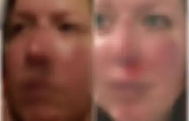 Tolak Tukar Pemberian Sumbangan dengan Tidur Bersama, Relawan Amal Ini Diserang 'Calon Donatur'