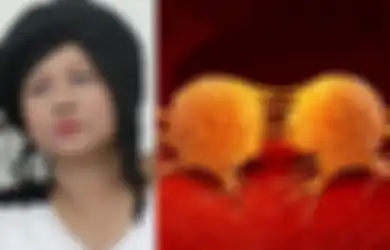 Ria Irawan Alami Metastasis: Faktanya, Kebiasaan Tidur Masyarakat Indonesia Ini Juga Bisa Bikin Sel Kanker Menyebar dengan Cepat dalam Tubuh
