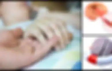 Sampai Bikin Tukul Arwana Alami Pendarahan Otak Akibat Stroke, Ternyata Hindari Stroke Sebenarnya Mudah Asal Mau Lakukan 6 Hal Ini
