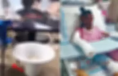 Ikuti Tutorial Memasak Popcorn dari Youtube, Dua Gadis Ini Cedera Bahkan Meninggal karena Ledakan Tepat di Wajah