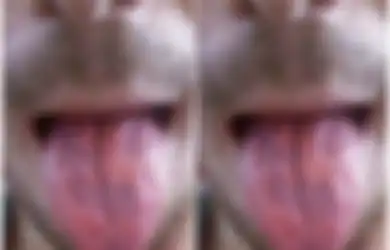 Keseringan Minum Minuman Berenergi, Lidah Pria Ini 'Habis' Terkelupas, Ini Sederet Bahaya yang Bisa Ditimbulkan dari Minuman Energi