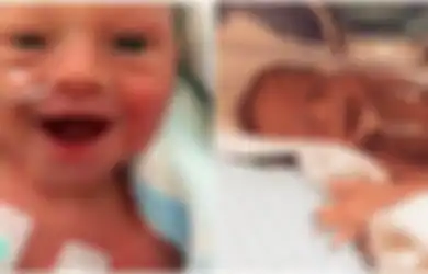 (Foto) Meski Terlahir Prematur, Bayi-bayi Mampu Menunjukkan Betapa Bahagianya Mereka Terlahir ke Dunia, Senyumnya Sangat Manis!