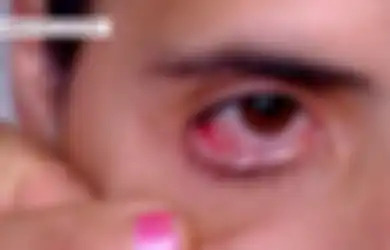 Aneh, Seorang Wanita Keluarkan Air Mata Kristal hingga 50 Butir Sehari, Dokter pun Sulit Mendiagnosis Kelainan yang Sebenarnya