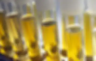 Coba Perhatikan Perubahan Air Kencing Anda, Waspada Jika Berbau Menyengat, Bisa Jadi Penyakit Berbahaya Sedang Menggerogoti