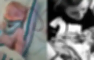 Tengkorak Bayi Ini Retak Setelah Jatuh dari Atas Kasur: Perhatikan 5 Hal Ini saat Bayi Terjatuh, Nyawa dan Masa Depannya Tergantung Padanya