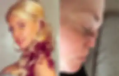 Hidung Wanita Ini Perlahan-lahan ‘Meleleh’ Setelah Dia Mengalami Kondisi Ini Ketika Epilepsinya Kambuh