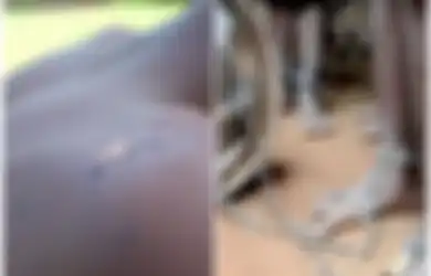 Kisah Korban Selamat dari Sekolah 'Rumah Penyiksaan' di Nigeria, Dibiarkan Kelaparan dan Digantung di Langit-langit