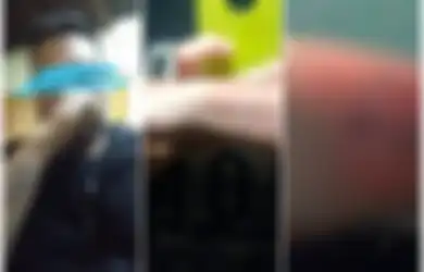 Ingin Masuk Kepolisian, Pemuda Ini Nekat Hapus Tato dengan Cara Sederhana Terinspirasi dari Video Tutorial, Tapi Begini Jadinya