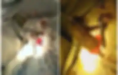 Muntah Setelah Makan dan Merasa Lemas, Gumpalan Rambut Setengah Meter Bersarang di Perut Seorang Gadis