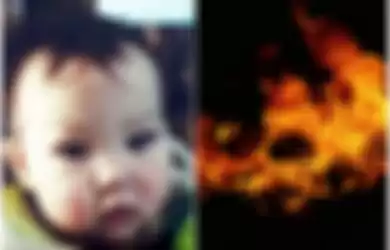 Tanpa Alasan yang Jelas, Bayi Malang Ini Dibakar Hidup-hidup oleh Kakek-Neneknya Usai Dititipkan sang Ibu