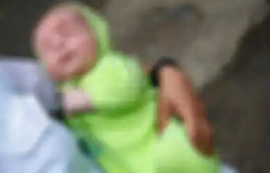 Kisah Bayi yang Terlahir Tanpa Bola Mata, Ditinggalkan Ibu Kandungnya, Kini Harus Jalani Operasi Setiap 6 Bulan