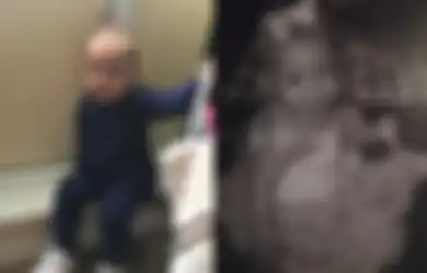 Nyawa Bocah 2 Tahun Ini Tak Selamat Gara-gara Tersedak Camilan, Ingatlah untuk Selalu dan Segera Lakukan Ini Jika Bayi Anda Tersedak
