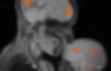 Foto MRI Otak Ini Diklaim Jadi 'Bukti' Begitu Eratnya Kasih Sayang Ibu dan Anak, Kok Bisa?