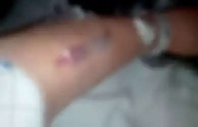 Berkeringat dan Merasa Sakit, Ibu Ini Kira Itu Hanyalah Tanda Menopause, Tapi Ternyata Dia Alami Kondisi Mematikan Ini