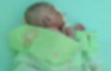 Bayi Ini Tersiksa Karena Kulitnya Keras Seperti Plastik dan Mengelupas hingga Berdarah, Simak Faktor Penyebab Dermatitis Seboroik dan Cara Merawatnya