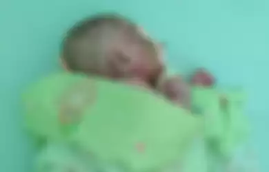 Mizyan Haziq Abdillah, bayi berusia 6 bulan dari wilayah perbatasan Kabupaten Nunukan ini menderita penyakit, kulitnya mengeras seperti plastik kemudian pecah dan mengelupas.