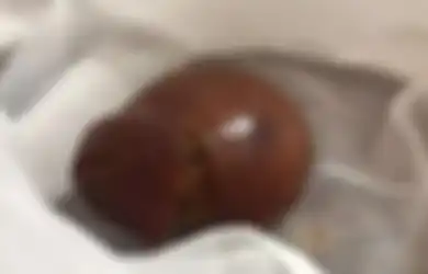 Punya Ayam Tak Kunjung Bertelur?  Cobalah Disembelih, Anda Mungkin Bisa Kaya Raya Jika Temukan Benda Ini