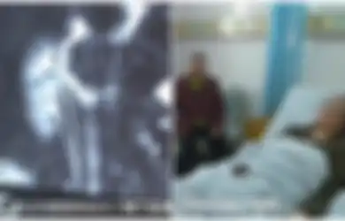 Mengeluh Alami Sakit pada Ginjalnya, Wanita Ini Malah Tertawa dan Menawarkan Ginjalnya Setelah Dokter Memberi Tahunya Hal Ini