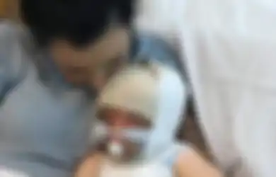 Ibunya Memasak Sambil Video Call, Balita Ini Terguyur 9 Liter Air Panas hingga Alami Syok Toksik
