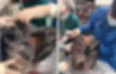 Terima Sumbangan Paru-paru Perokok, Dokter Terheran-heran Melihat Wujudnya Sampai Ogah Menerimanya