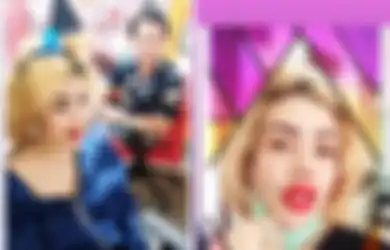 Bibir Barbie Kumalasari Bengkak Karena Sulam Bibir: Ingat, Sulam Bibir Sama Dengan Masukan Tinta ke Dalam Tubuh Kita