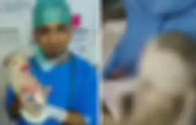 Bayi di India viral di media sosial karena kondisi yang mengerikan dan dikabarkan telah memakan usus ibunya.