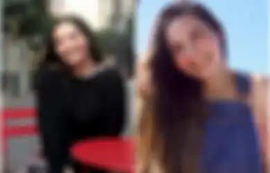 Mahasiswi Cantik Ini Hanya Mandi 2 Kali Sebulan Karena Alergi Air, Keringat atau Air Matanya Sendiri Bisa Memicu Demam dan Ruam