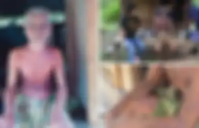 10 Tahun Jauhi Keluarga dan Tetangga Karena Takut Penyakitnya Menular, Kini Pria Ini Diberitahu Fakta yang Mengejutkan Dirinya
