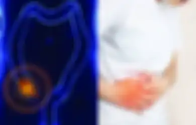 Merasakan Sakit Saat Batuk atau Berjalan? Ini Salah Satu Gejala Usus Buntu dan Ini Penyebabnya