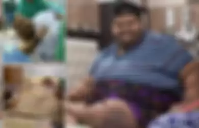 Kisah Mihir Jain, Jadi Anak Terberat di Dunia dengan Bobot Mencapai 200 Kg Lebih Hingga Sulit Membuka Kelopak Matanya Sendiri