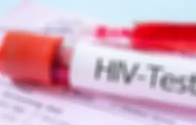 Kasus HIV/AIDS di Bandung Capai 12.358 Kasus: Sudah Meninggal, Pria Ini Baru Ketahuan Punya 40 Pacar Sampai Beri 'Warisan' Mengerikan Ini