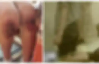 Dihukum Berlutut 9 Jam di Atas Biji-Bijian oleh Ayah Tiri, Lutut Bocah Ini Harus Dioperasi Karena Hal Ini