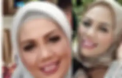 Ely Sugigi Potong Gigi Bagian Depannya: Ini Efek Samping Potong Gigi Menurut Dokter