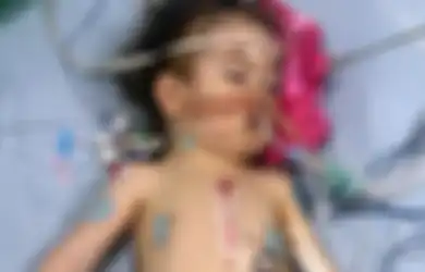 Bayi Mungil Ini Lahir dengan Empat Kelainan Sekaligus, Termasuk Jantung yang Salah Tempat, Kondisinya Kini Bikin Dokter 'Geleng-geleng'