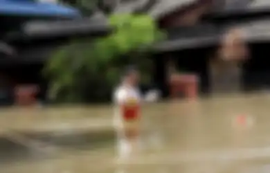 Anak Anda Terpapar Banjir? Waspadai 7 Penyakit Akibat Banjir Ini, Salah Satunya Akibat Kencing Tikus