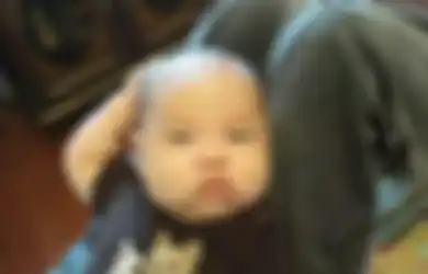Bayi Itu Terus Menyentuh Kepalanya, Orang Tuanya Mengira Hanya Gatal, Tetapi Karena Terlalu Sering Orang Tuanya Membawanya ke Dokter, Ternyata Situasinya Gawat