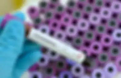 Ilmuwan Ungkap 3 Skenario Berakhirnya Wabah Virus Corona, Kabar Buruknya Virus Ini Disebut Tidak Akan Musnah