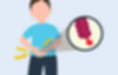 Gejala Usus Buntu Akut Umumnya Dimulai dengan Sakit Perut di Sekitar Pusar Kemudian ke Arah Ini dan Sakitnya Meningkat