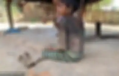 Seperti 'Neraka Kehidupan', Tubuh Gadis 7 Tahun Ini Berubah Jadi 'Batu', Duduk Saja Kesakitan Apalagi untuk Jalan