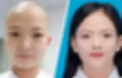 Shan Xia, perawat asal Wuhan yang rela menggunduli rambut untuk melawan virus corona.
