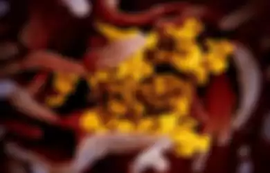 Gambar mikroskop elektron pemindai ini menunjukkan virus corona Wuhan atau Covid-19 (kuning) di antara sel manusia (merah). Sampel virus diambil dari seorang pasien AS yang terinfeksi. Para ahli menambahkan gambar agar lebih tampak.
