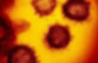 Ini adalah gambar mikroskop elektron transmisi yang menunjukkan coronavirus baru yang muncul dari permukaan sel manusia.