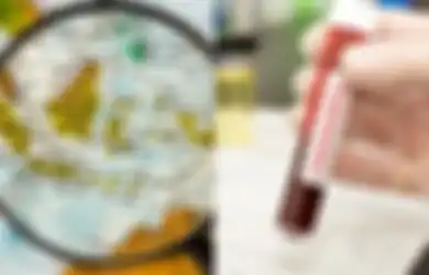Bulan Maret Telah Berlalu, Ilmuwan Indonesia Peringatkan Badai Puncak Virus Corona di Indonesia Akan Segera Tiba Diprediksi Pada Tanggal Ini