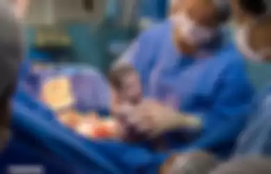 Foto bayi yang baru lahir dari proses operasi sesar tunjukkan