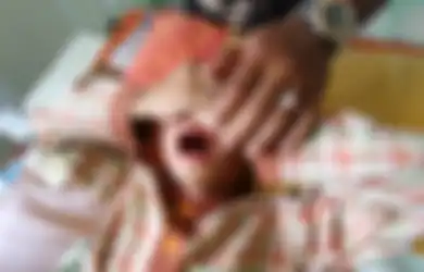 Pulang Mengantar Anaknya Sunat, Seorang Ayah Nyaris Pingsan Usai Membuka Perban di Alat Vital Si Bocah 3 Tahun