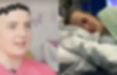 Kulit Kepala Rasanya Seperti Terbakar Saat Rambutnya Tumbuh, Wanita Cantik Ini Idap Alergi Pada Segala Hal, Bahkan Air Mata Juga Rambutnya Sendiri