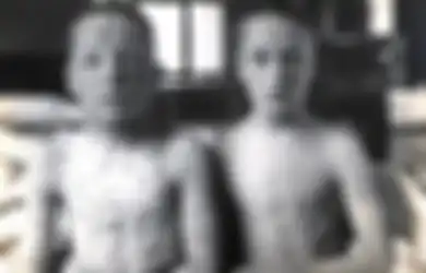 Musnahkan 300 Juta Manusia dan Pernah Dijadikan Senjata Biologis, Inilah Pandemi yang Berhasil 'Dijinakkan' Manusia, Kini Orang-orang Malah Bersyukur Jika Terinfeksi Penyakit Ini 