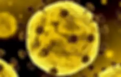 Rahasia di Balik Virus Corona Terbongkar, Ilmuwan Beberkan Alasan Sampai Bisa Menyebar ke Seluruh Dunia, Ternyata Berawal dari Kecerobohan China Ini